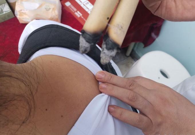 艾灸可以“调阴阳，和气血”用艾灸来增益生命健康