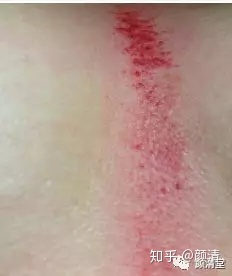 �为什么要刮痧?从痧相来看你的身体健康�����.jpg �为什么要刮痧?从痧相来看你的身体健康�����.jpg