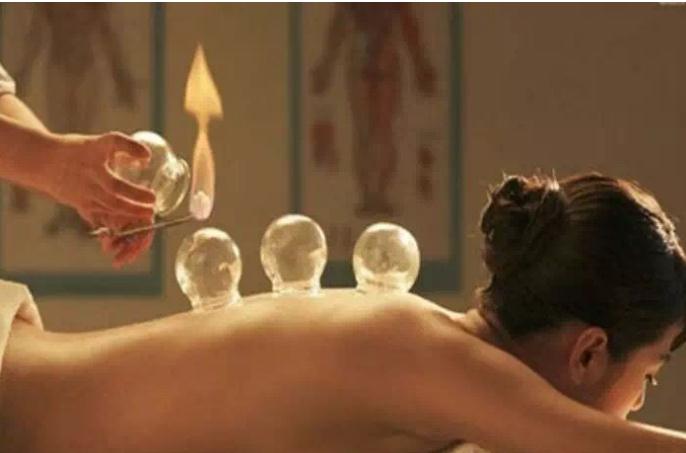 拔罐疗法，你真的懂吗？