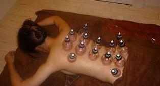 艾灸补虚人，刮痧治壮汉　看懂艾灸与刮痧、拔罐的区别