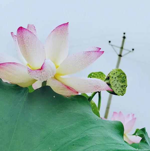 接触过针灸，你就知道针灸的魅力比中药好了很多倍