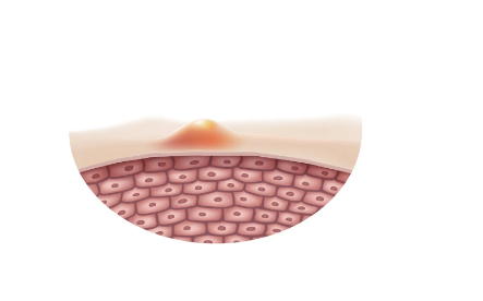 熬夜的几大影响
